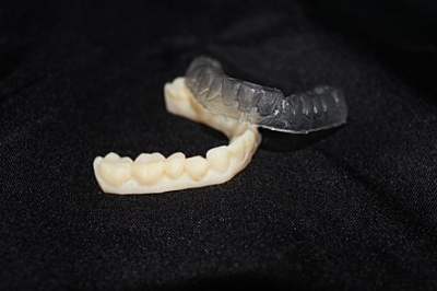 Réalisation de gouttières orthodontiques